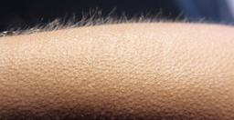 Tại sao chúng ta lại "nổi da gà"?