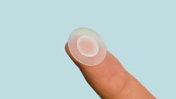 Có nên tự nặn mụn không?