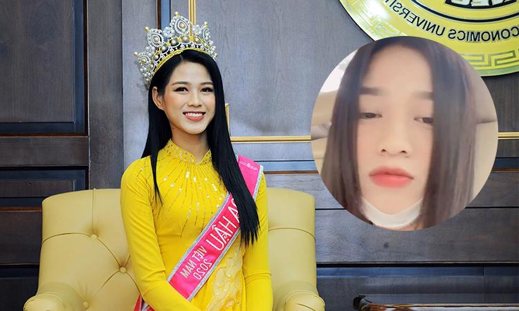 Hoa hậu Đỗ Thị Hà: Nhuộm đen làm gì để bây giờ lại phải "bóc đen"!