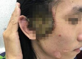 BV Da liễu TP.HCM ghi nhận số ca lây qua đường tình dục tăng cao