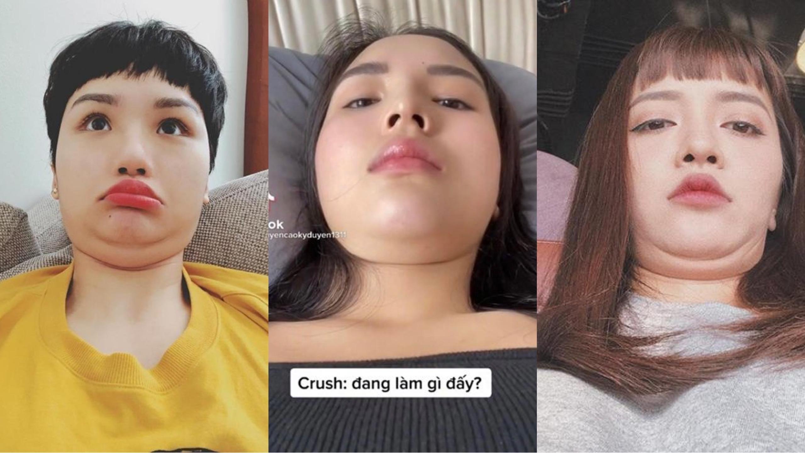 Hoa hậu Kỳ Duyên và loạt mỹ nhân Việt thi nhau khoe... nọng cằm