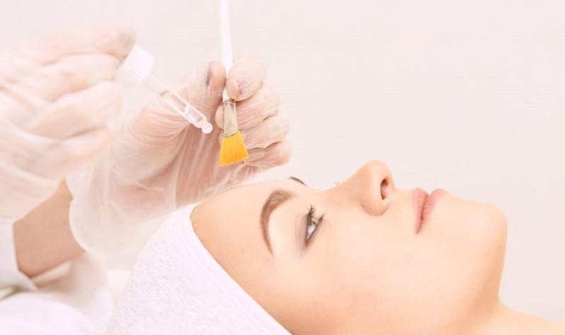 Peel da giá bao nhiêu? Các yếu tố ảnh hưởng? Địa chỉ peel da uy tín