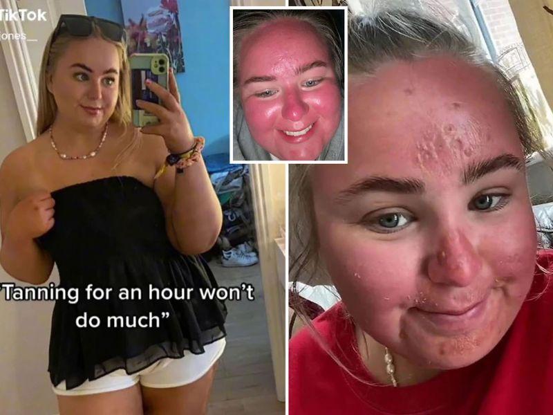 Sự thật về cô gái phơi nắng một giờ, gương mặt lập tức to lên gấp đôi