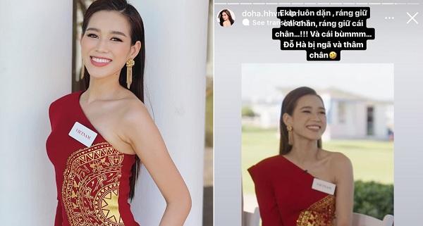 Đôi chân 1m11 của Đỗ Thị Hà bị thâm tím trong clip Miss World đăng tải