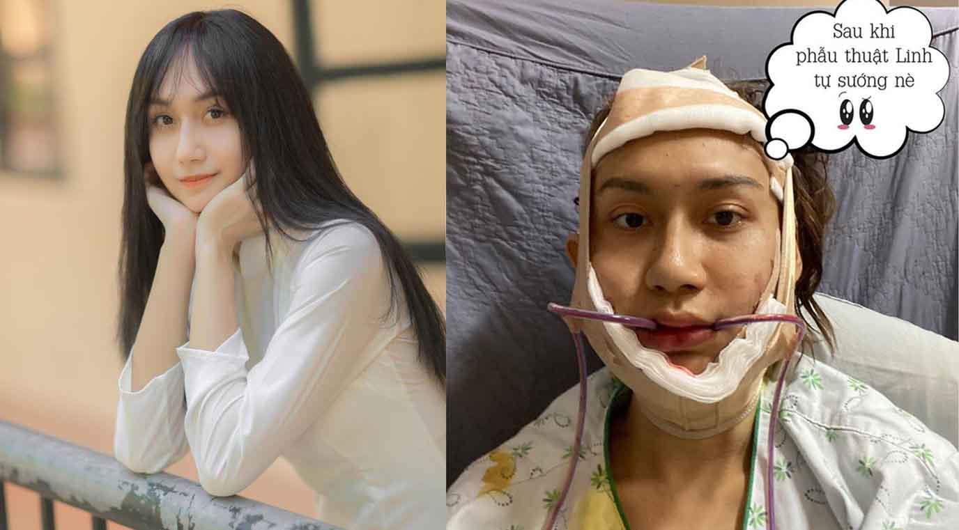 Hơn 1 tỷ đồng là số tiền Lynk Lee đã chi để trở thành mỹ nhân như hiện tại