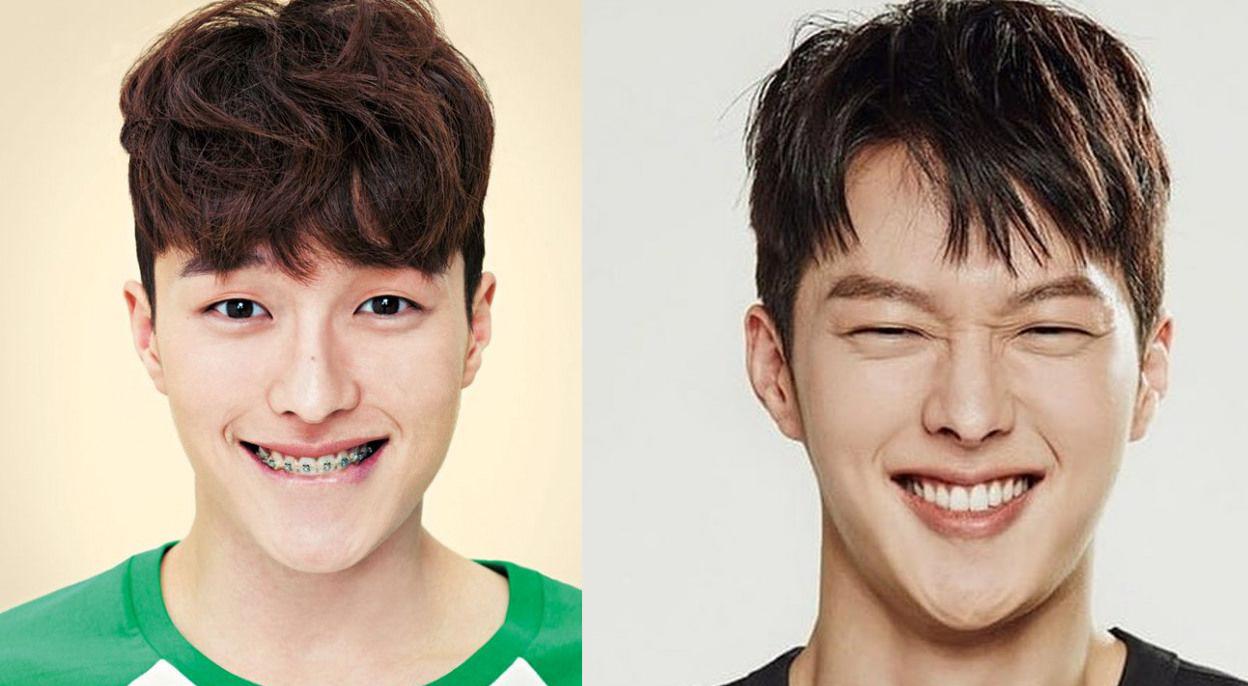 Tình trẻ của Song Hye Kyo - Jang Ki Yong và dàn mỹ nam Hàn "lột xác" ngoạn mục nhờ niềng răng