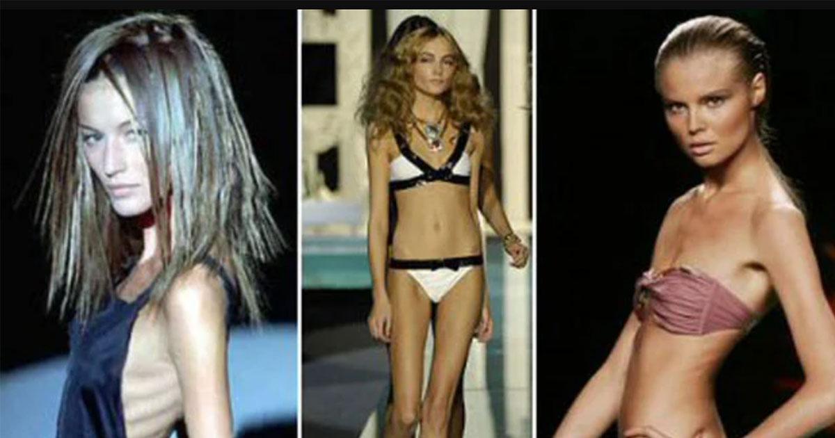 Cơn ác mộng người mẫu "Size 0": Người mẫu nhịn ăn, "Bạch Cốt Tinh" hiện hình trên sàn diễn