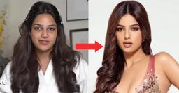 5 cách đánh bay quầng thâm mắt cấp tốc cho những cô nàng phải thường xuyên chạy "deadline"