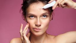 Hướng dẫn cách chăm sóc da sau trị mụn, giảm thâm mờ sẹo hiệu quả