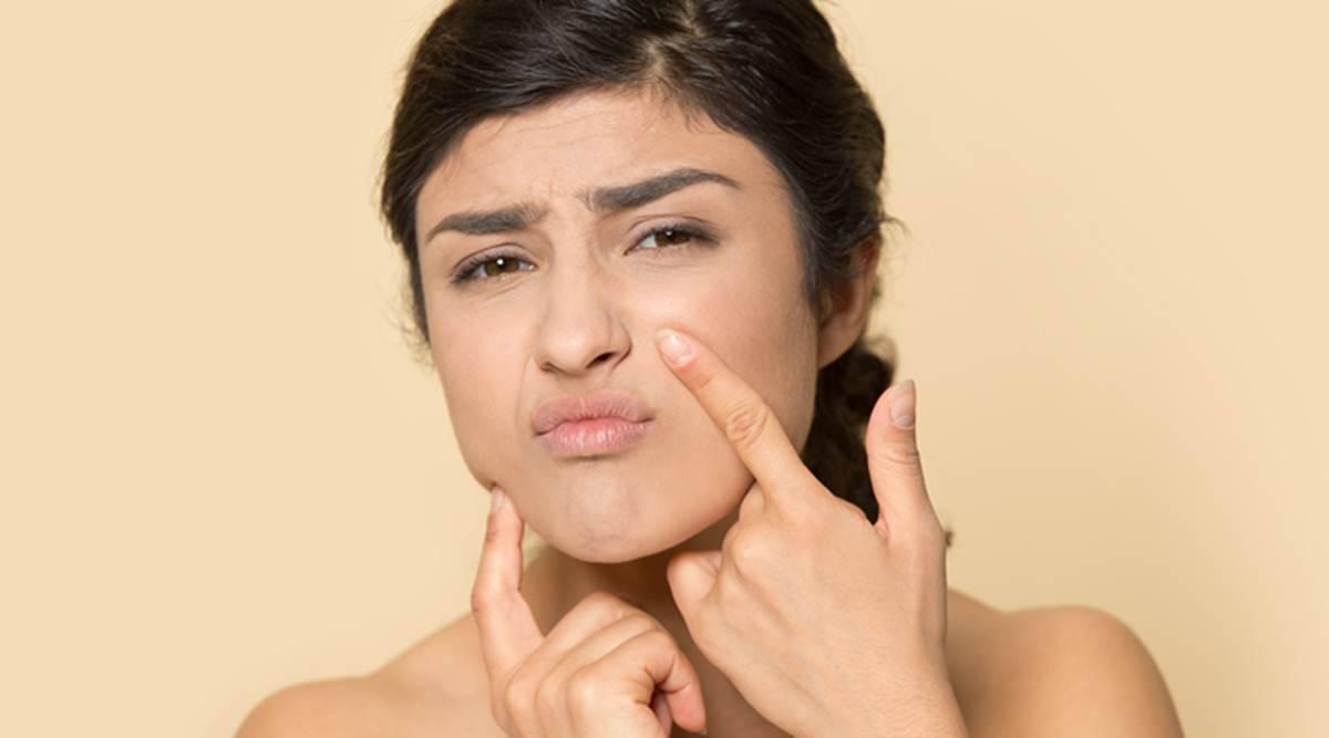 Giải đáp: Sản phẩm chăm sóc da khô loại nào tốt nhất hiện nay?