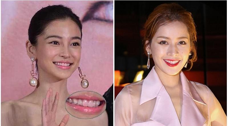 Lỗi trang điểm phổ biến tới nỗi từ Anglela Baby, Phạm Băng Băng đến Chi Pu ai ai cũng mắc