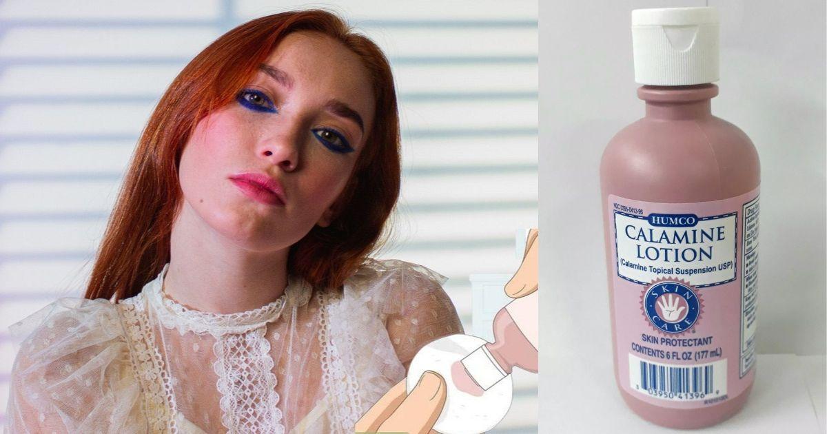 Mối nguy hại khủng khiếp từ kem dưỡng da chứa calamine