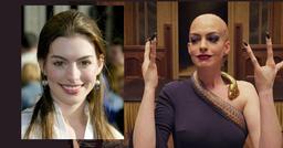 6 nguyên nhân gây rụng tóc - khắc phục việc rụng tóc để không bị hói