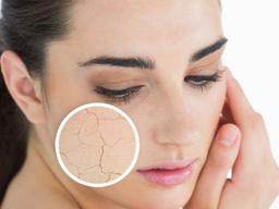 Đây là cách khắc phục da khô sần, thiếu nước trong những ngày đông