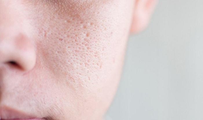 Mẹo trang điểm giúp lỗ chân lông trở nên tàng hình