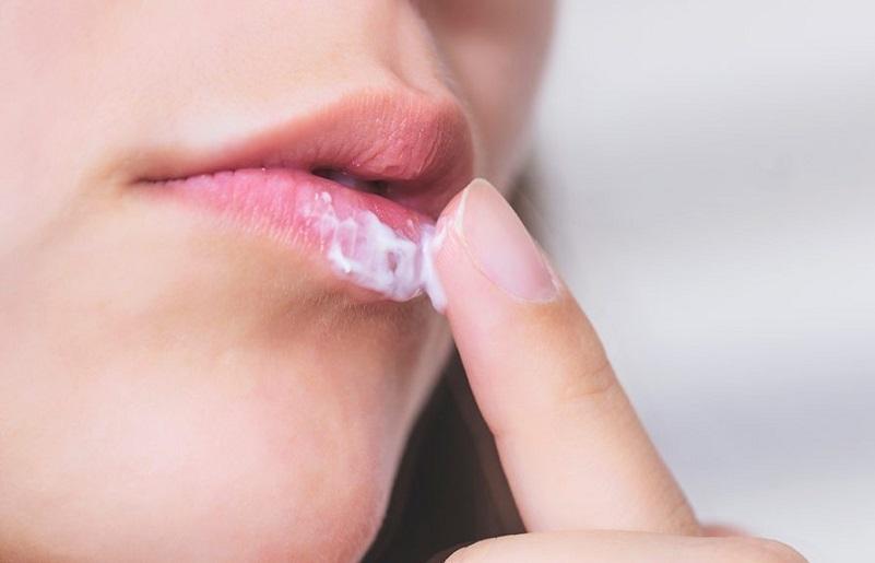 Bật mí cách trị mụn rộp ở môi cho đôi môi xinh tươi