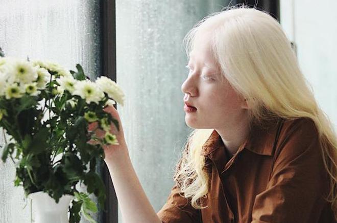 Người mẫu Việt bạch tạng đẹp như một nàng thơ