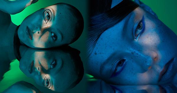 Người mẫu có gương mặt đầy tan nhang nhưng vẫn nổi danh thế giới