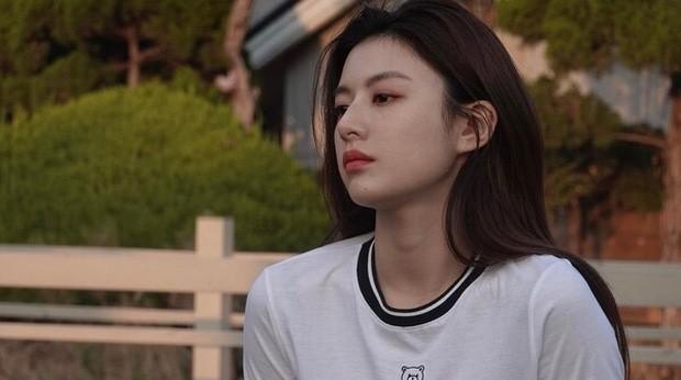 Hóa ra “chuẩn mực thẩm mỹ” Go Yoon Jung không chỉ dừng lại ở việc làm mũi