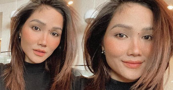 Cưng xỉu trước nốt ruồi "pha-ke" H’Hen Niê tự tay bôi lên mặt để... trị mụn