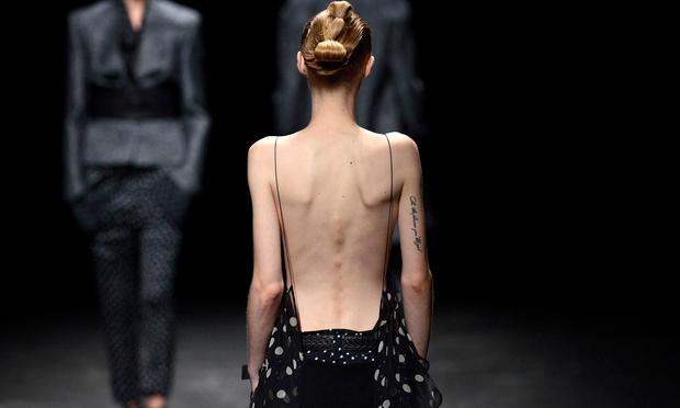 Yves Saint Laurent từng bị chỉ trích vì ưu ái người mẫu siêu gầy