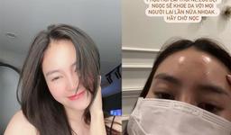 Ninh Dương Lan Ngọc thức khuya và cái "kết đắng" dành cho làn da