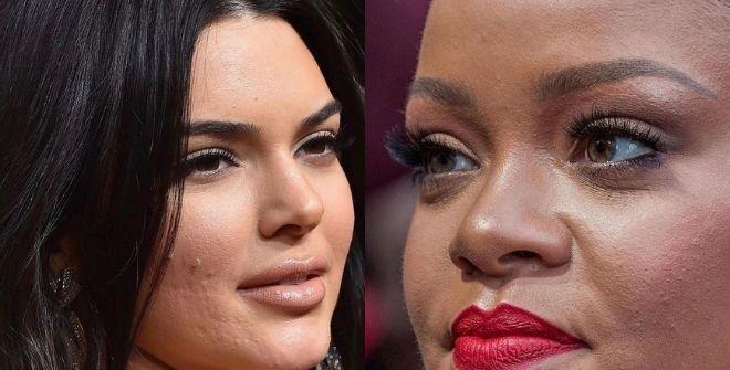 Nếu "zoom" cận mặt, các ngôi sao US - UK còn là mỹ nhân?