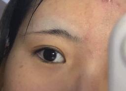 Những phương pháp làm đẹp chị em không nên thử tại nhà nếu không muốn mất Tết