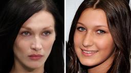 Bella Hadid thú nhận rất hối hận vì đã can thiệp dao kéo một bộ phận trên gương mặt