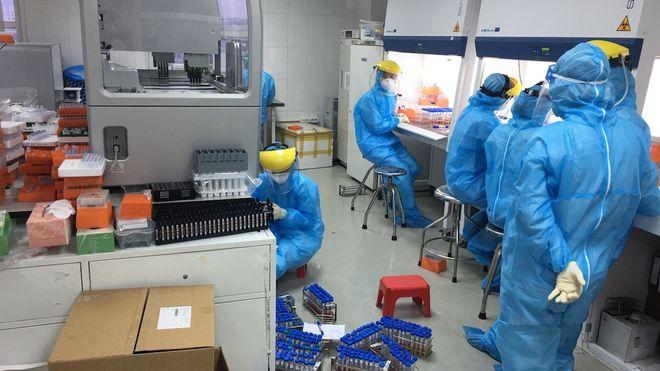 Kết quả xét nghiệm 585 F1 liên quan đến người Nhật nhiễm Covid-19 ở Hà Nội