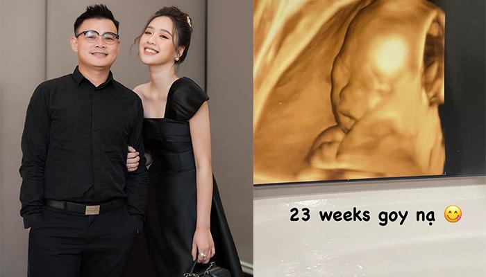 MC Hà My bạn gái triệu phú công nghệ khoe phiếu siêu âm thai sau nghỉ việc ở VTV