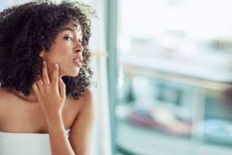 Chuyên gia mách bạn mẹo hay xử lý tất cả các loại thâm, sẹo mụn