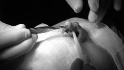 Lâm Đồng: Đứt trụ mũi do "bác sĩ Sài Gòn" đến nhà nâng mũi thẩm mỹ