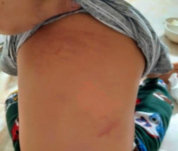 Ninh Bình: Trẻ 15 tháng bị cô giáo đánh trong nhà vệ sinh, 1 cô đứng nhìn