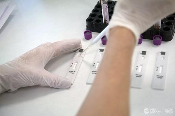 Lý giải nguyên nhân thành niên vừa dương tính Covid-19 lại âm tính ngay