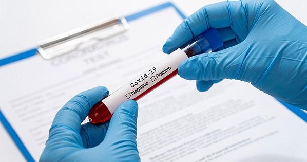 Test nhanh giúp phát hiện Covid-19 có giá bao nhiêu?