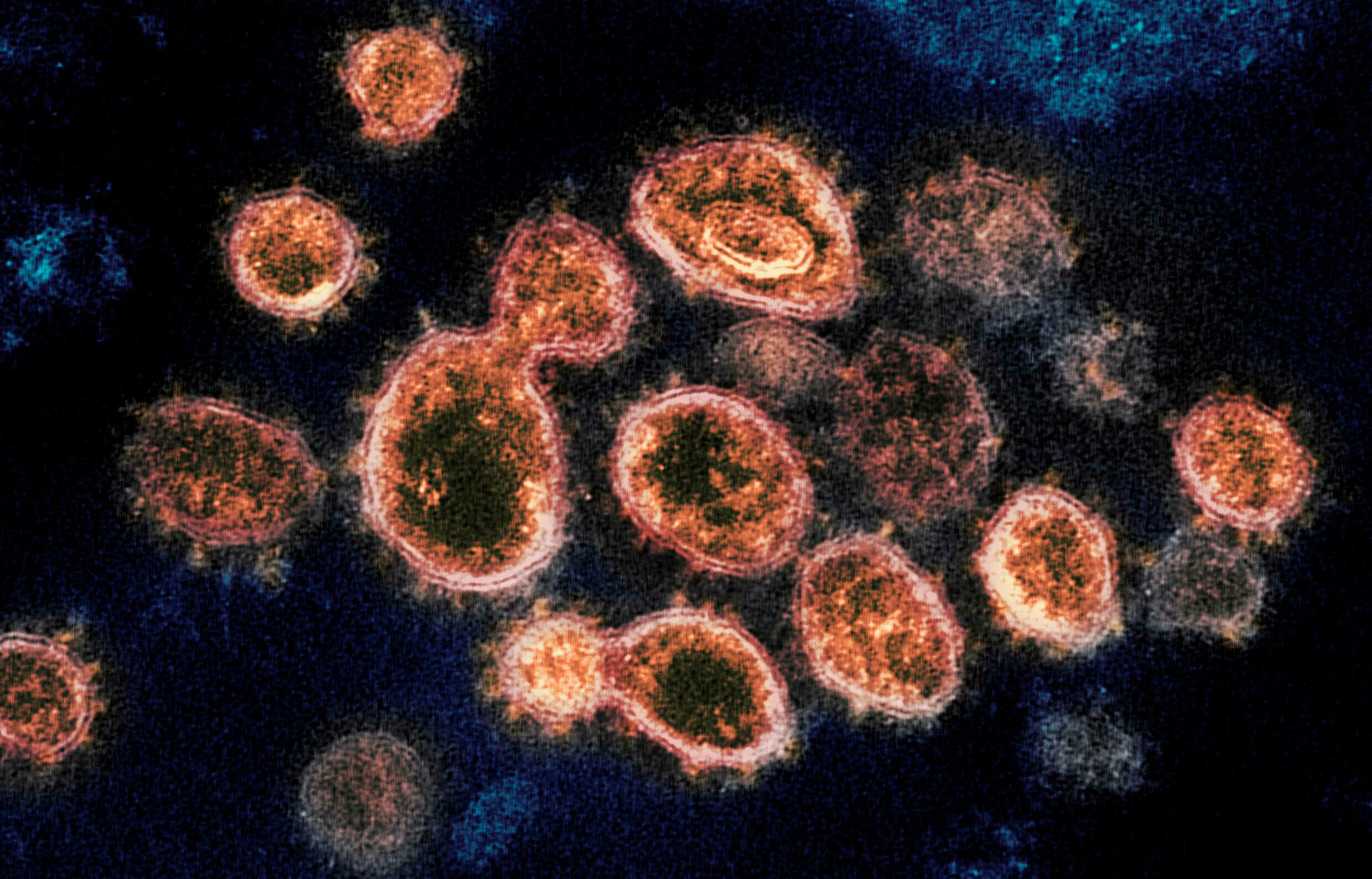 Chuyên gia Đức cảnh báo biến chủng nCoV có khả năng kháng vaccine Pfizer, AstraZeneca