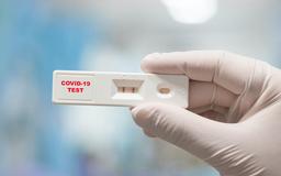 Sau test nhanh có kết quả dương tính tại nhà, người dân không được tự ý vào viện