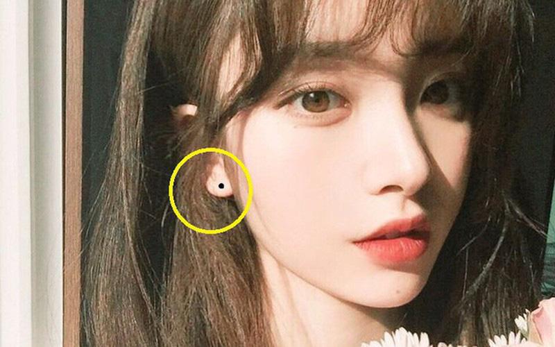 Có nốt ruồi ở vị trí này là người giàu sang, trung vận cực vượng đừng dại tẩy đi