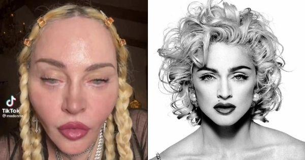 Huyền thoại Madonna khiến netizen choáng với gương mặt biến dạng ở tuổi 63