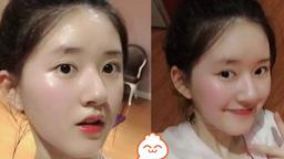 Triệu Lộ Tư lên sóng MXH vì ảnh chụp bằng cam thường năm 18 tuổi: Mũi cao, da mịn như em bé