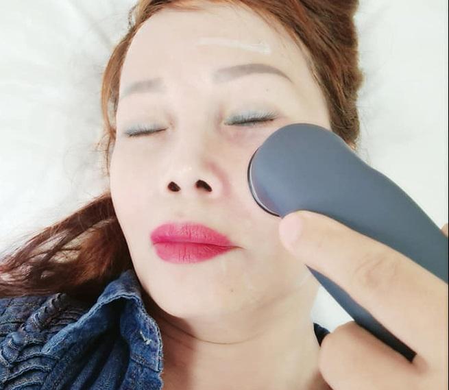 "Cô dâu 62 tuổi" điều trị méo miệng sau cuộc đại phẫu căng da mặt