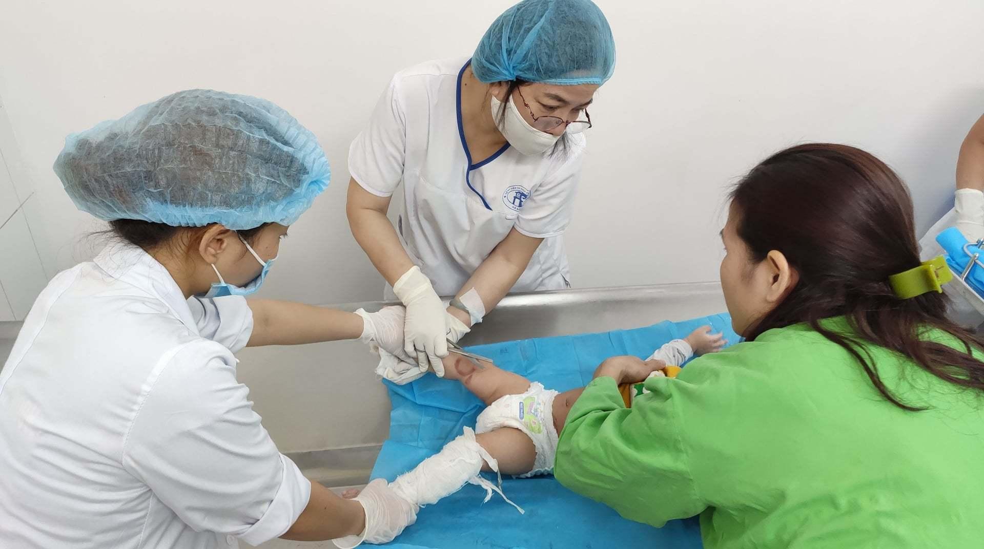 Trẻ bị bỏng nghiêm trọng và cách sơ cứu sai lầm của bố mẹ