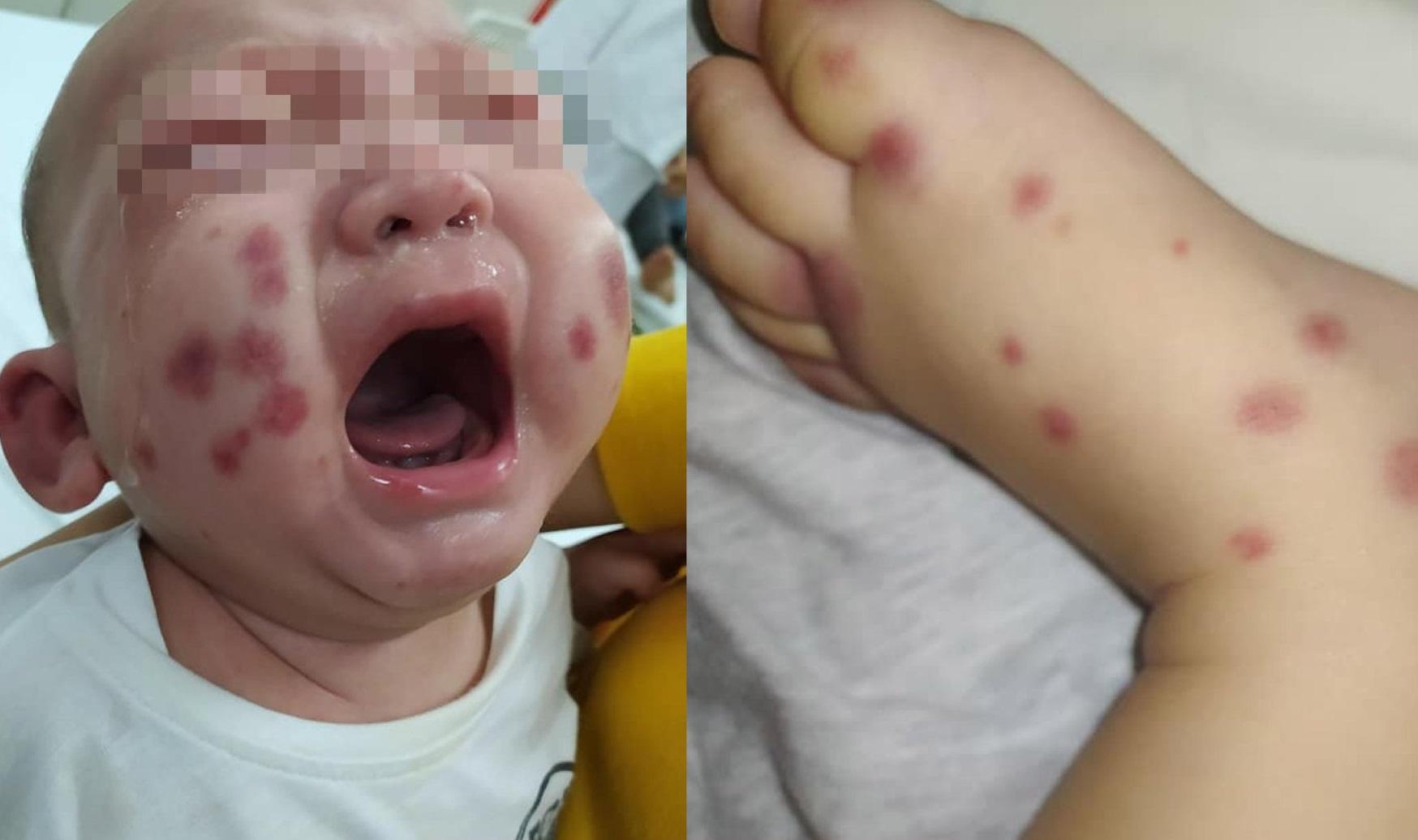 Việt Nam phát hiện và điều trị một ca bệnh cực hiếm, cả thế giới chỉ có 300-500 người.