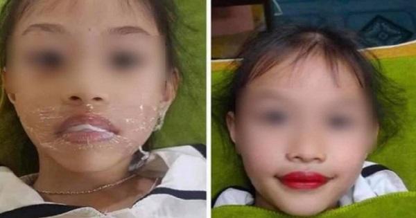 Xôn xao clip bé gái mới 5 tuổi đi xăm môi theo yêu cầu của mẹ