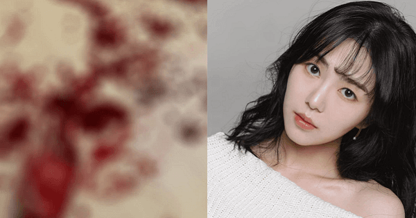 Nghi vấn Kwon Mina (cựu thành viên AOA) tự tử lần 3 khi đăng ảnh bàn tay đầy máu