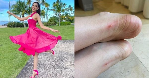 Ngày thứ ba tại Miss World, đôi chân "quốc bảo" của Đỗ Thị Hà đã sưng tấy