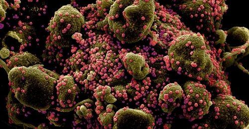 Nhật Bản phân lập thành công biến thể Covid-19 ở Anh